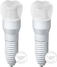 Implantatloesungen mit SDS Keramik02